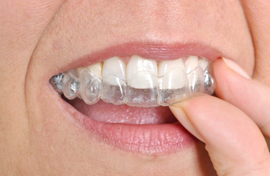 Woman putting in her invisible braces