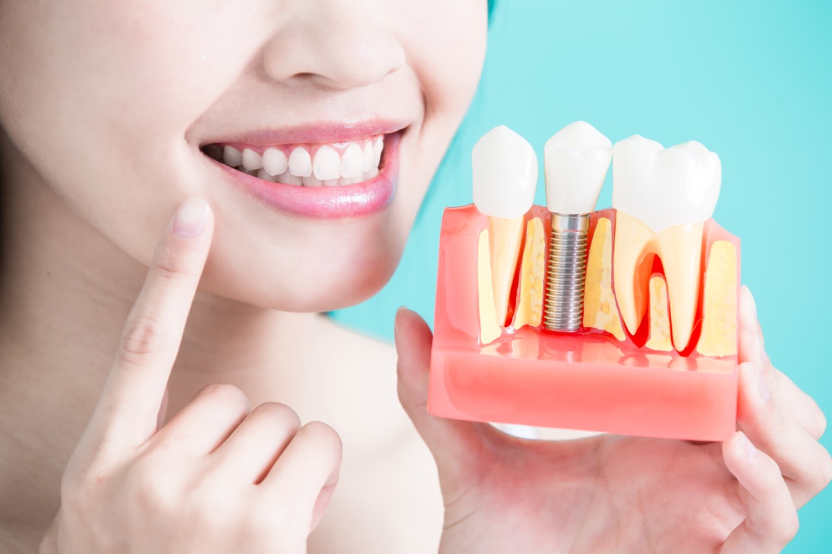 girl holding a teeth implant model