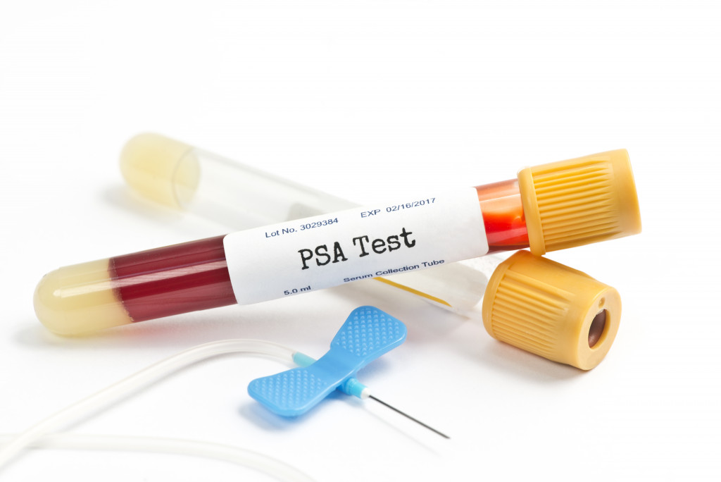 PSA blood test in test tube